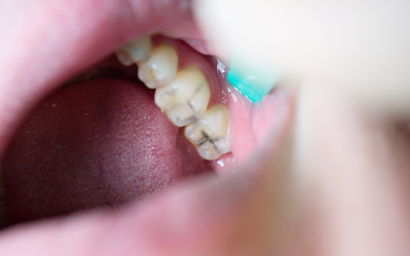 wfpha-blog-preview-oral-health.3